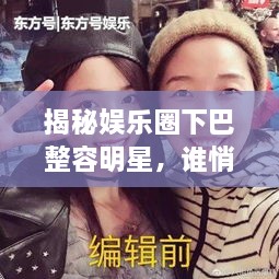 揭秘娛樂圈下巴整容明星，誰悄悄整過下巴？